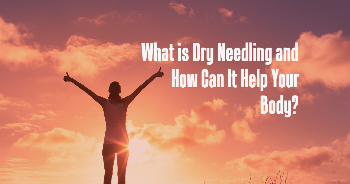What is Dry Needling and How Can It Help Your Body?